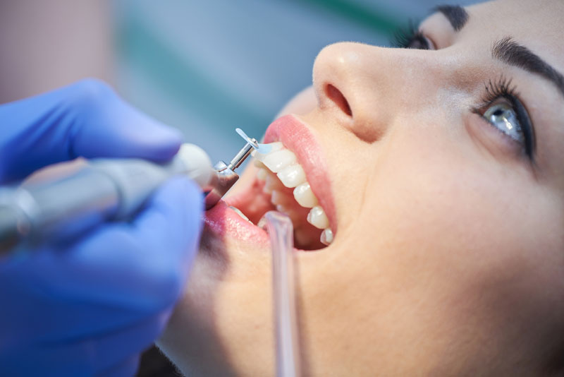 dental patient undergoing teeth cleaning